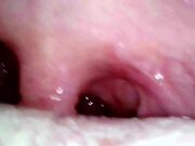 入学初日的体检1