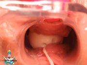 稀缺资源阴道内放置跳蛋高清近景内窥镜看阴道内部变化白浆往外流