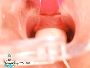 稀缺资源阴道内放置跳蛋高清近景内窥镜看阴道内部变化白浆往外流