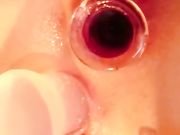 超萌萝莉下体双洞塞被塞满 淫液流不停